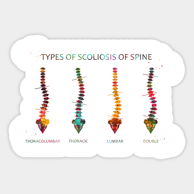 Type of scoliosis of spine Sticker by erzebeth